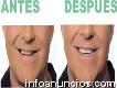 Implantes dentales, carillas, blanqueamiento estética dental (011) 4589-6349